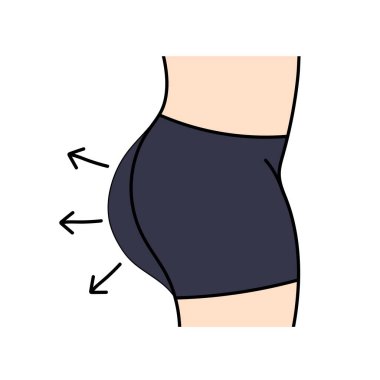 Kadınlar estetik cerrahi kalça büyütme elle çizilmiş renk vektörü çizimi