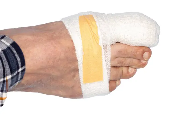 Blízký Záběr Muže Pravou Nohou Zraněným Palcem Zabalte Obvaz Ochranu — Stock fotografie
