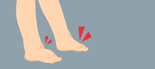 Vektor Illustration Svullna Fötter Njurproblem Inom Hälso Och Sjukvård — Stock vektor
