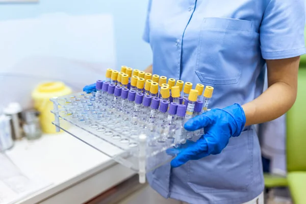 Técnico Que Realiza Teste Tubo Sanguíneo Laboratório Pesquisa Teste Coronavírus — Fotografia de Stock