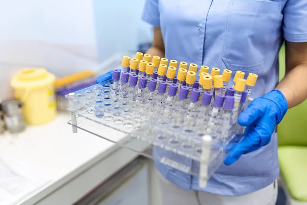 Technicien Tenant Test Tube Sanguin Dans Laboratoire Recherche Test Coronavirus — Photo