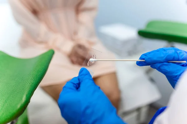 Esfregaço Vaginal Close Mão Médico Detém Instrumentos Exame Ginecológico Ginecologista — Fotografia de Stock
