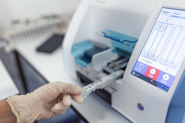 Female laboratory assistant making analysis with test tubes and analyzer machines sitting at the modern laboratory, lab tech loading samples into a chemistry analyzer