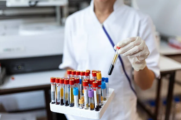Ruční Odběr Vzorku Krve Racku Stroji Analýzy Laboratoři Technik Který — Stock fotografie