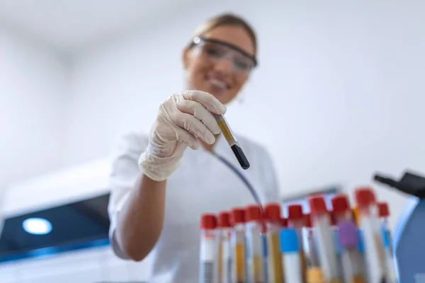 Doctor Hand Taking Blood Sample Tube Rack Machines Analysis Lab — Stock Photo, Image