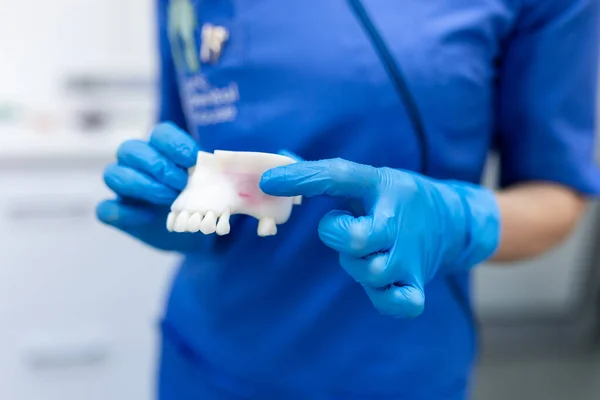 Cultivez Dentiste Femelle Méconnaissable Uniforme Gants Latex Tenant Modèle Plâtre — Photo