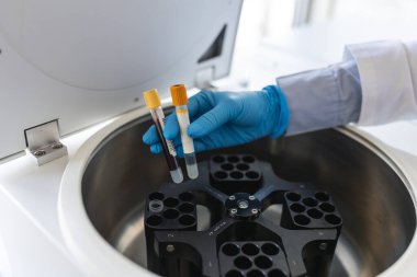 Teknisyen tıbbi ya da bilimsel laboratuvar santrifüj makinesi için bir örnek yükleme