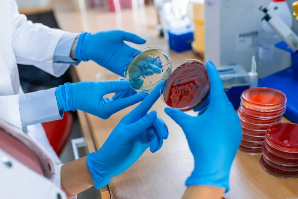 科学家的手拿着一个装有细菌的培养皿 以科学的专业接枝细菌为重点 在花瓣盘中进行嫁接 镜头集中在琼脂板上 — 图库照片