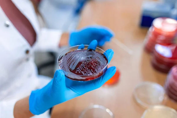 Scientifique Tenant Une Boîte Pétri Avec Des Clones Bactériens Technicienne — Photo