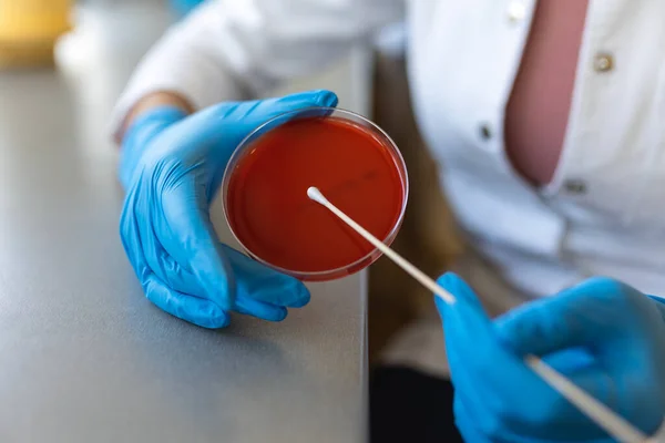 Καθαρή Καλλιέργεια Βακτηρίων Στο Πιάτο Άγαρ Επιλεκτική Εστίαση Τρυβλίο Petri — Φωτογραφία Αρχείου