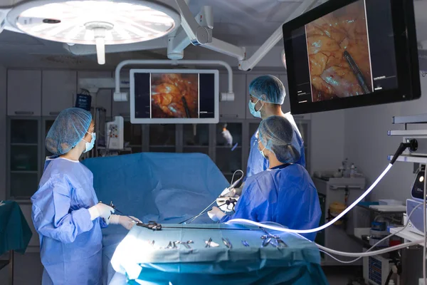 Drei Chirurgen Bei Laparoskopischen Eingriffen Ärzte Betrachten Das Bild Auf — Stockfoto