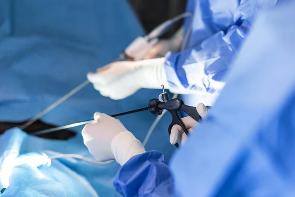 Chirurg Zaszył Przyrząd Brzuchu Pacjenta Chirurg Przeprowadza Operację Laparoskopową Sali — Zdjęcie stockowe