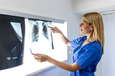 Radyoloji ve tıp konsepti. Doktor, akciğer taramasının sonuçlarını yaşlı hastaya açıklıyor..