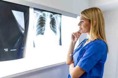 Radyoloji ve tıp konsepti. Doktor, akciğer taramasının sonuçlarını yaşlı hastaya açıklıyor..