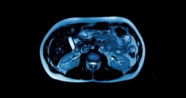 在扫描特写时显示人体部位的医学扫描 — 图库视频影像