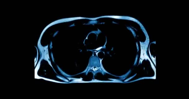 Медичне Сканування Показує Частину Людського Тіла Під Час Сканування Крупним — стокове відео