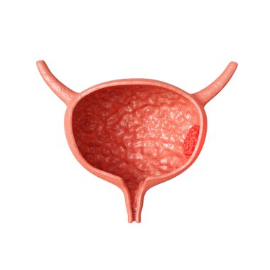 İdrar kesesi beyaz arka planda izole edilmiş. İdrar kesesi kanseri konsepti. 3d oluşturma