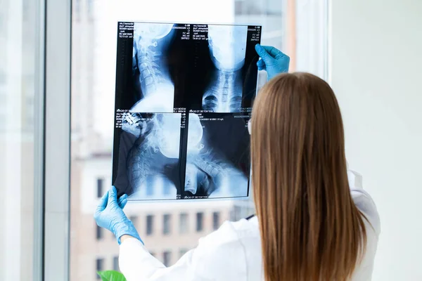 Female doctor or radiologist examines a neck x-ray of a patient in a hospital