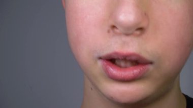 Metal telli dişler. Yakından gülümse. Ben Mouth. Ergen yüzü.