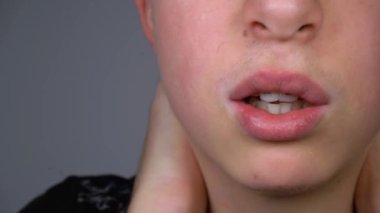 Diş telli dişler. Yakından gülümse. Ben Mouth. Gülümseyen ergen yüzü.