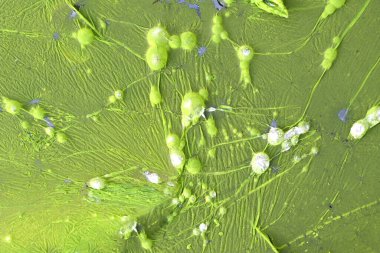 Green bacteria colony forming bubbles on contaminated sewage water clipart