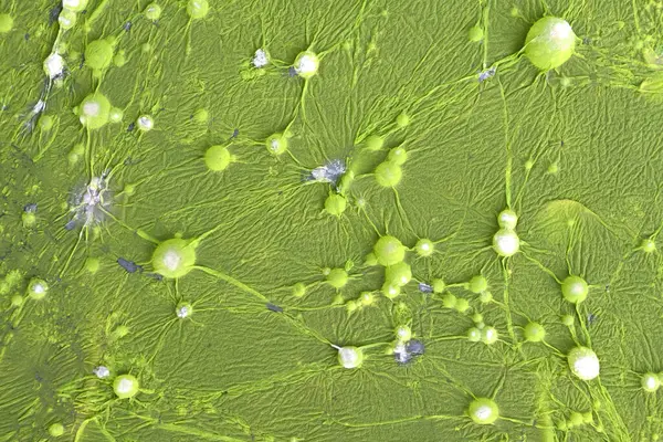 Green bacteria colony forming bubbles on contaminated sewage water