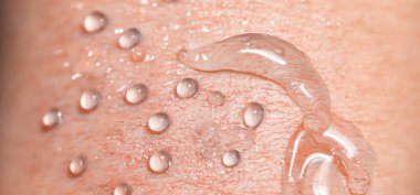 Kolajen ve Hyaluron Serum Cildi. Hyaluron jeli sıçraması. Deride sıvı hyaluronik asit jeli. İnsan derisinin arka planında kozmetik su jeli dokusu. Dokulu arka plan. cilt bakımı ürünü.