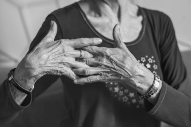 80 yaşındaki kadın elleri ostheo artrit, şişmiş eller ve parmak, eklem iltihabı, kıkırdaktaki bozulma tazminatı eksikliği yüzünden..