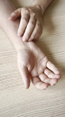 Yara izi olan el kaşındırıyor. Yüksek kalite 4k görüntü