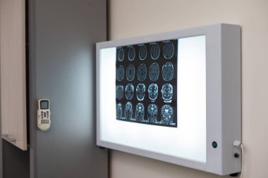 Tıbbi Laboratuar Hastası MRI veya CT Tarama İşleminden Doktor ve Radyoloji Kontrol Odasında Gözetim altında Geçerken, İşlem İzler ve Beyin Etkinliği Sonuçlarını İzlerler.