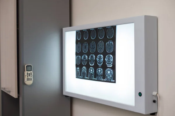 In Medical Laboratory Patient Undergoes MRI or CT Scan Process under Supervision of Doctor and Radiologist in Control Room, They Watche Procedure and Monitors Brain Activity Results.