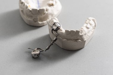 Diş protezlerinin alçı modelleri. Takma dişlerin gösteri modelleri. Ortodontik protezlerin görsel gösterimi. Takma diş. Protez dişçilik. Diş plakası üst görünüm. Yapay diş.