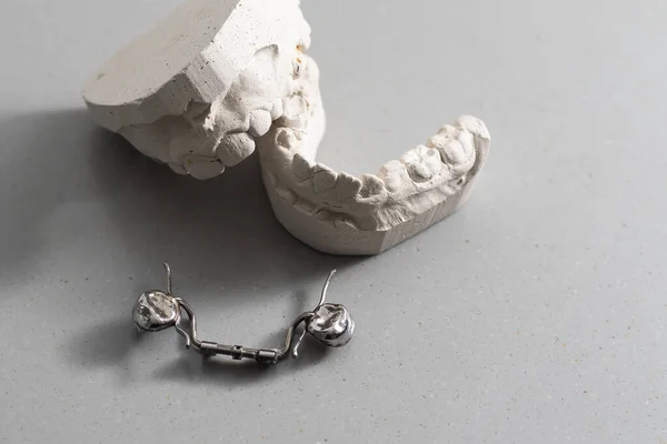 Plaster models of dental prostheses. Demonstration models of dentures. Visual demonstration of orthodontic prostheses. False teeth. Prosthetic dentistry. Dental plates top view. Artificial tooth.
