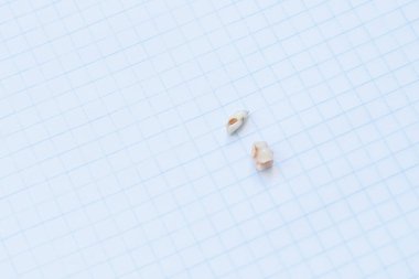 Diş çürüğü. Kötü çürümüş dişler..