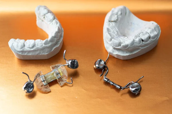 歯科鋳造石膏モデル石膏鋳造組織学的な人間の顎の人工実験室 — ストック写真