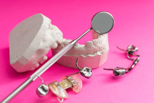 Modele Dentystyczne Widok Góry Modelki Szczęk Różnymi Problemami Koncepcja Leczenia — Zdjęcie stockowe
