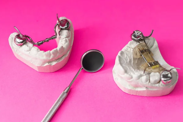 Οδοντιατρικά Μοντέλα Μοντέλα Σαγονιού Διαφορετικά Προβλήματα Θεραπεία Της Έννοιας Των — Φωτογραφία Αρχείου