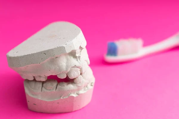 歯ブラシとモック人間の顎 プラスター下顎 歯科医療の概念 曲がった歯 歯医者と歯医者の助け — ストック写真