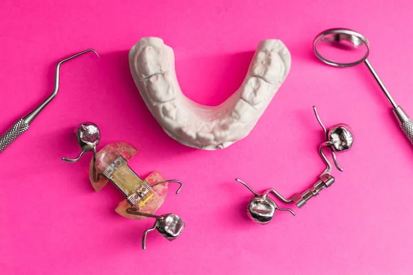 Вигляд Стоматологічних Моделей Моделі Щелеп Різними Проблемами Лікування Стоматологічних Захворювань — стокове фото