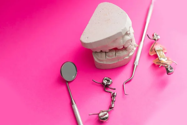 歯科モデルのトップビュー 異なる問題を持つ顎モデル 歯科疾患の概念の治療 人間の歯の石膏モデル 歯科医や歯列矯正医の訓練のための視覚援助 歯科目録 — ストック写真