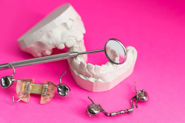 Piring Gigi Piring Gigi Untuk Menyelaraskan Gigi Pada Anak — Stok Foto