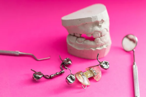 Zubní Odlévání Sádry Model Sádry Odlitek Stomatologické Lidské Čelisti Protetické — Stock fotografie