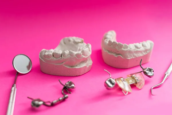 Modelos Dentales Vista Superior Modelos Mandíbula Con Diferentes Problemas Concepto — Foto de Stock