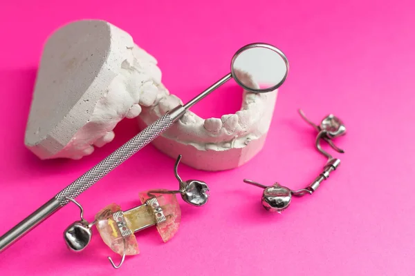 Colada Dental Yeso Modelo Yeso Fundido Estomatológico Mandíbulas Humanas Laboratorio —  Fotos de Stock