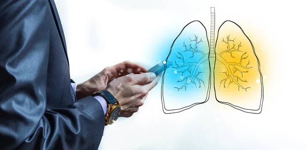 Доктор Руці Показує Сканування Легень Людини Високоякісна Фотографія — стокове фото