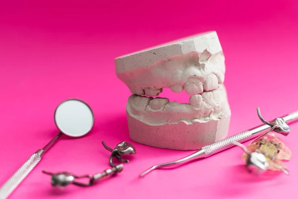 Tandplaten Tandplaten Voor Het Uitlijnen Van Tanden Bij Een Kind — Stockfoto