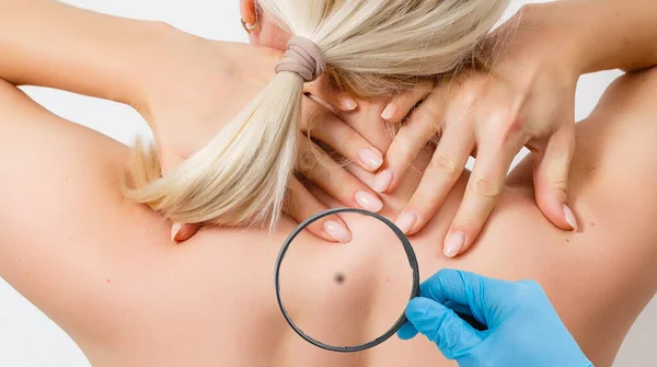 Bijgesneden Weergave Van Dermatoloog Onderzoek Van Huid Van Patiënt Met — Stockfoto