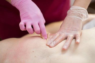 Güzellik uzmanı spa salonundaki şeker ezmesi kullanarak erkeğin göğsünden istenmeyen kılları alıyor. Erkek kılları alınıyor. Epilasyon ustası bir erkeğin göğsünden keskin gözyaşları döker.