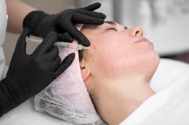 Kozmetik uzmanının yakın çekimi güzellik kliniğinde bir kadının cildini sıkmak için canlandırıcı yüz enjeksiyonu prosedürünü uygular. Biorevitalizasyon prosedürü
