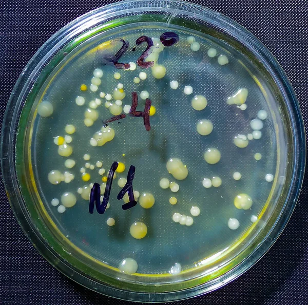 Kolonies Pathogene Bacteriën Een Petrischaaltje Microbiologisch Onderzoek — Stockfoto